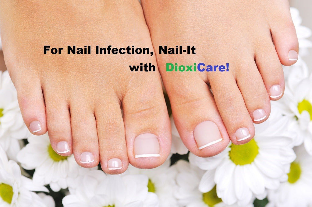 Get rid of toe nail fungus